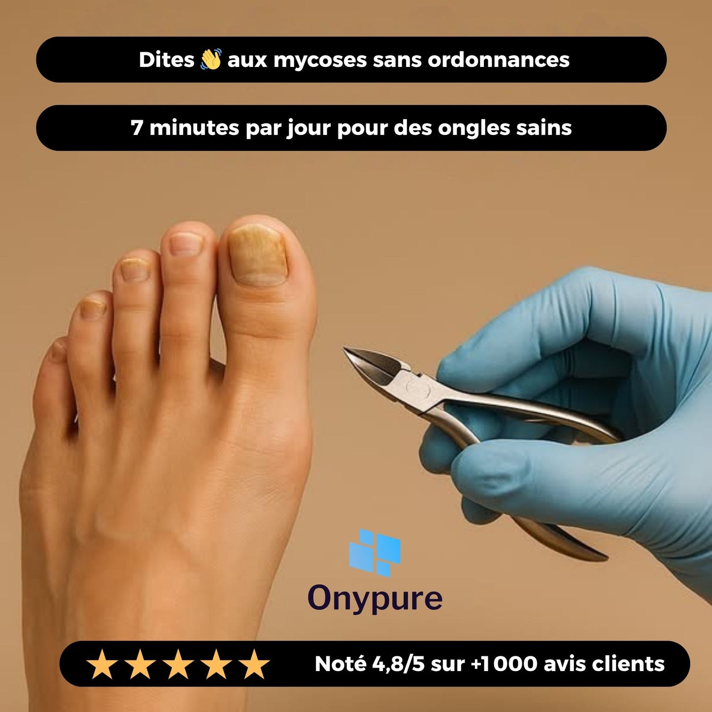 OnyPure™ - Solution Laser LED Avancée contre l’Onychomycose