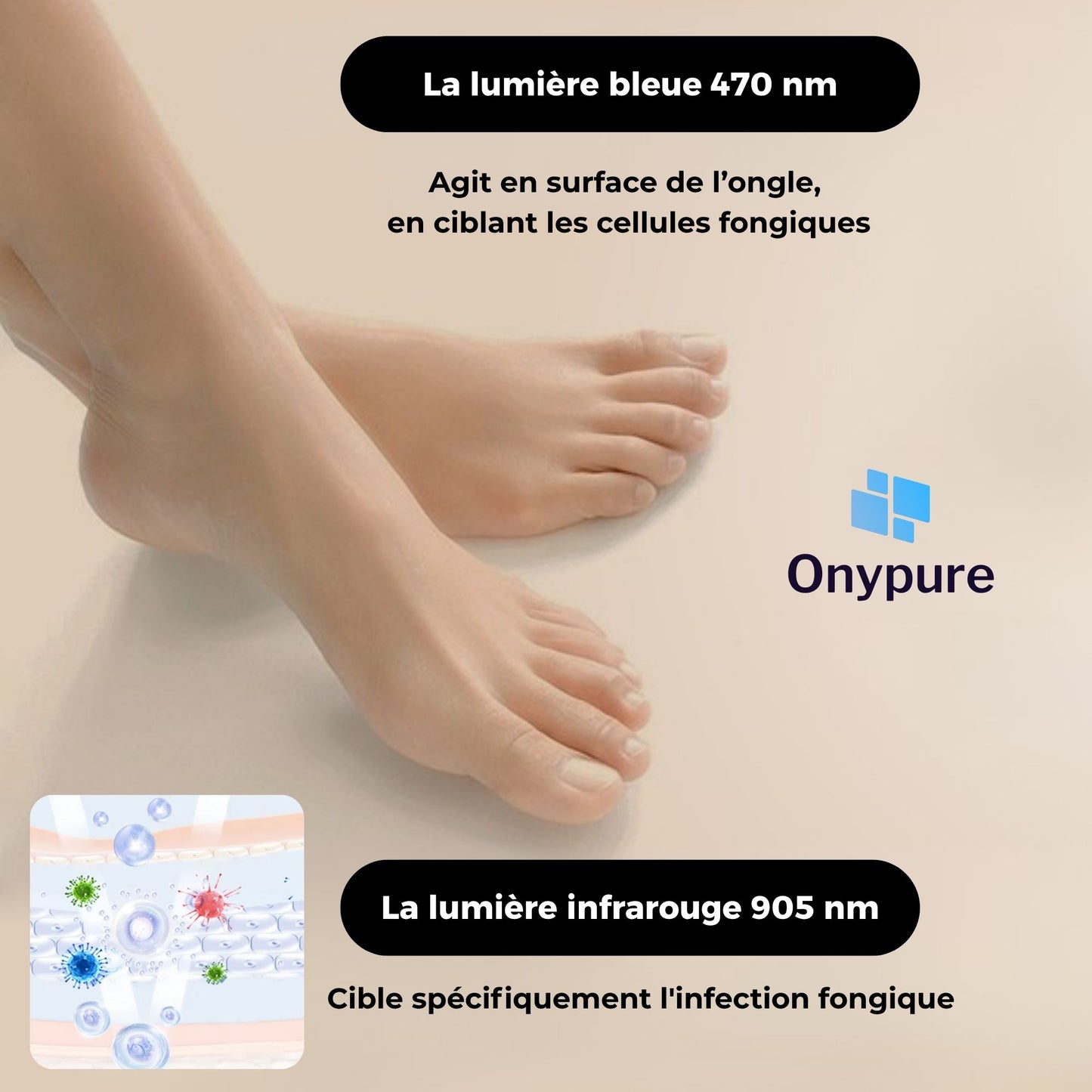 OnyPure™ - Solution Laser LED Avancée contre l’Onychomycose
